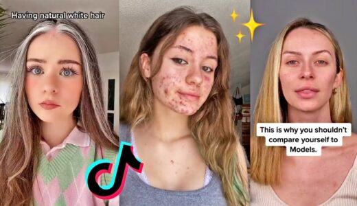 Embracing Body Insecurities (Body Positivity) *Part 2* | TikTok Compilation