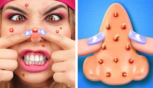 Don’t touch the PIMPLES *Amazing TOYS and GADGETS from Tik Tok*